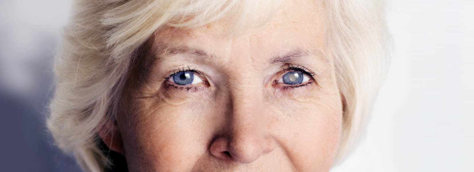 Cataract Surgery in Paynesville